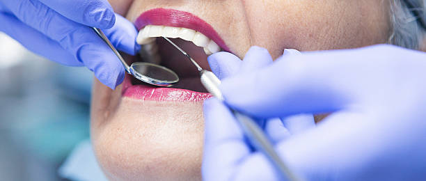 Best Emergency Wisdom Teeth Removal in Frederick, CO